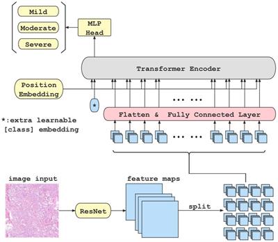 Studying pulmonary fibrosis due to microbial infection via automated microscopic image analysis